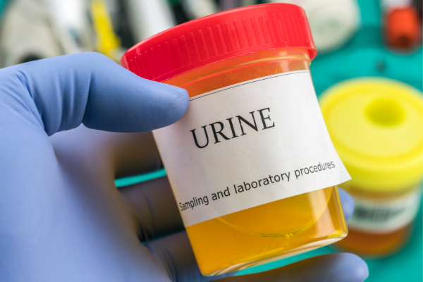 urine sample